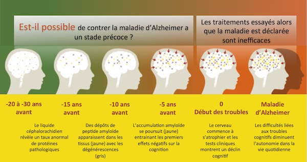 L'essai clinique DIAN-TU